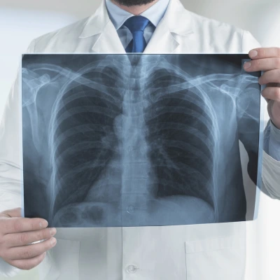 radiografie a domicilio
