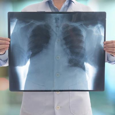 radiografie a domicilio roma